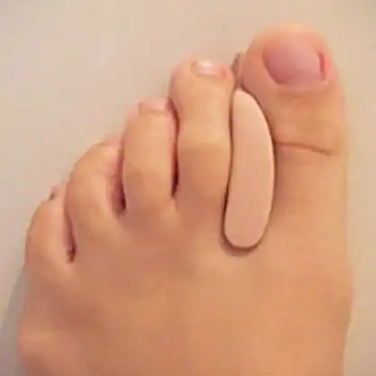 orthoplastie